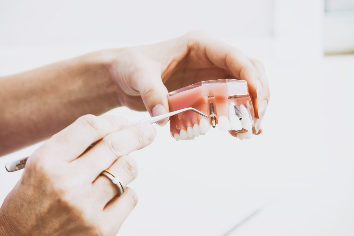 Dental Implant Recovery Facts You Need to Know