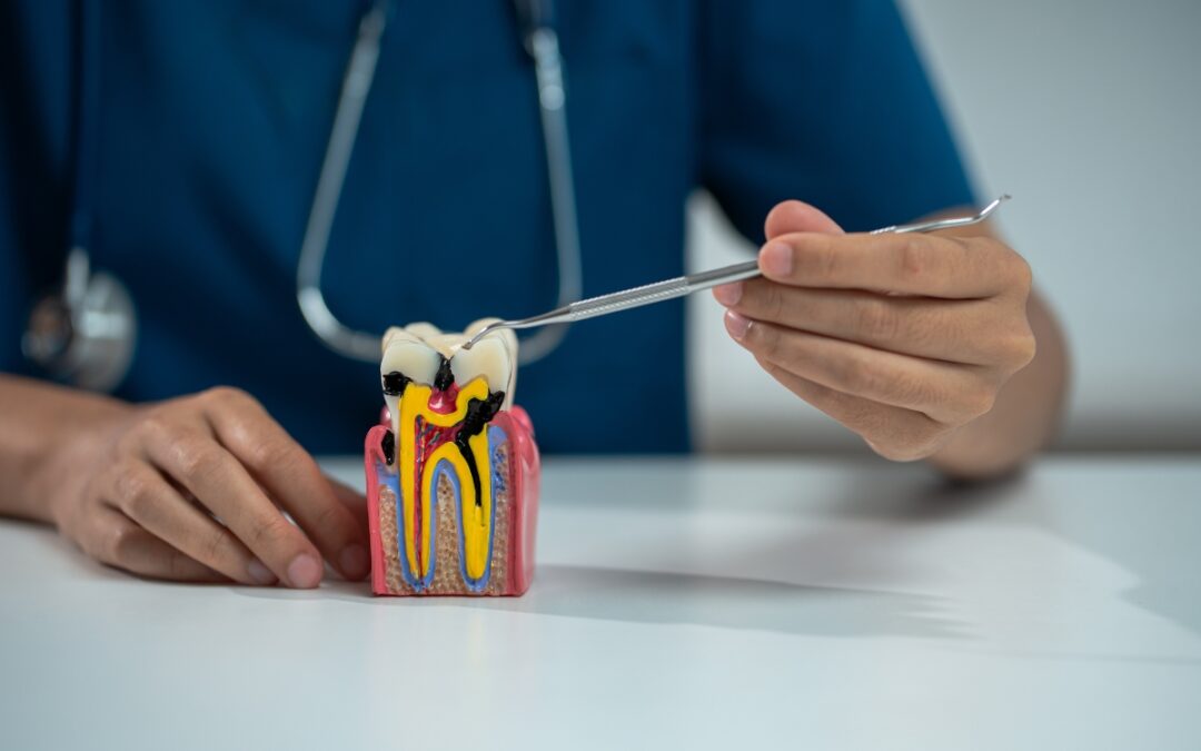 Does Root Canal Therapy Cause Your Chronic Health Issues?
