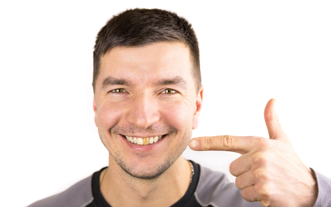 Tooth Turning Black But No Pain? Know the Reasons