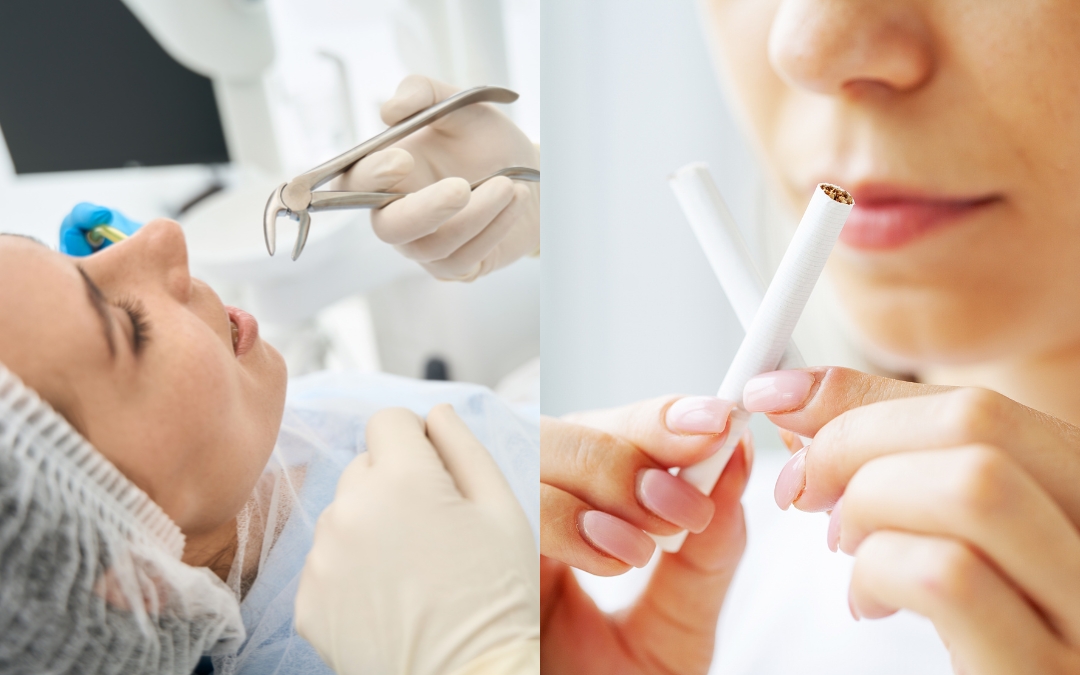 Can You Smoke After Having a Tooth Pulled While Wearing Gauze?
