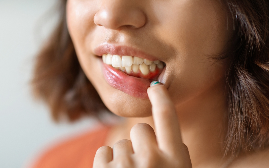 What Is the Best Antibiotic for a Gum Infection?
