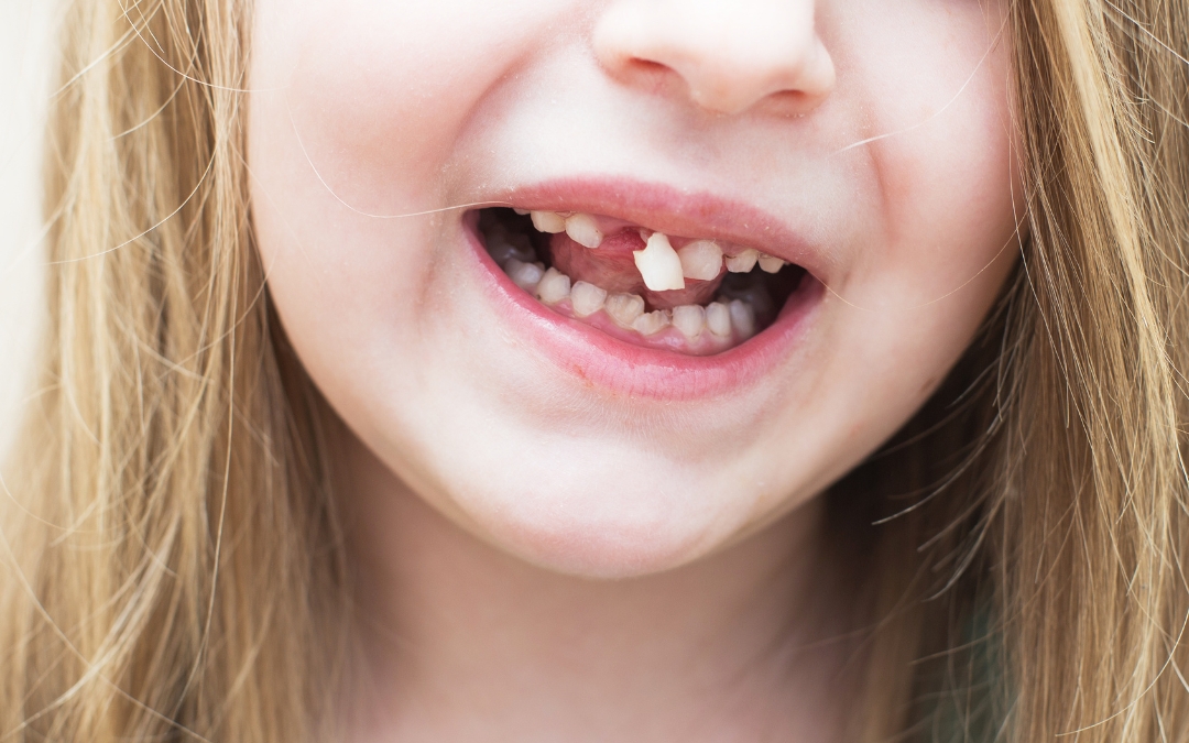 Does Your Child’s Permanent Tooth Still Grow If It’s Broken?