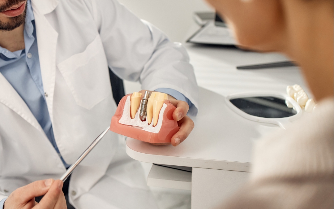 What Happens If I Have a Bone Graft But Not an Implant?