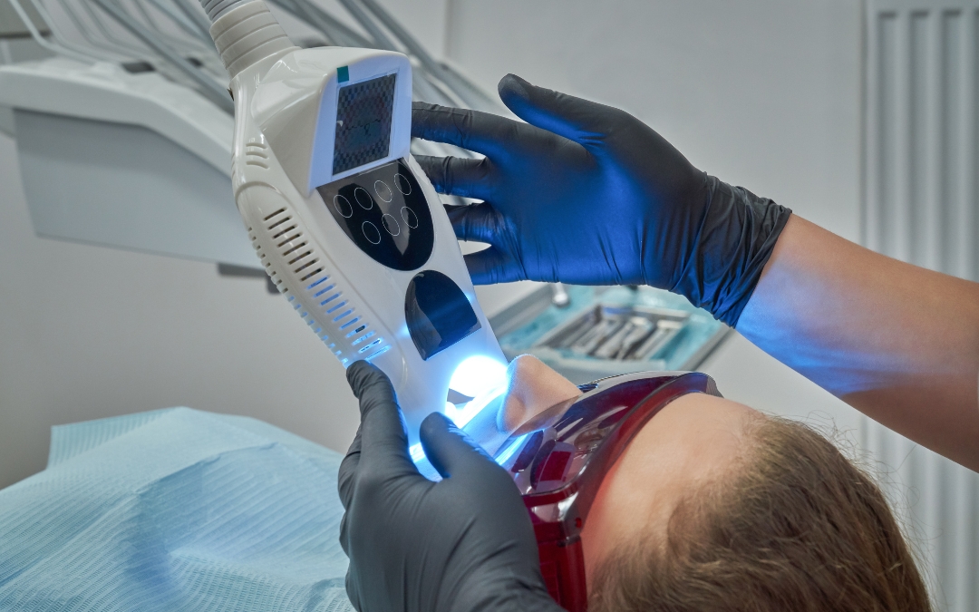 How Do You Treat Burning Gums from Teeth Whitening
