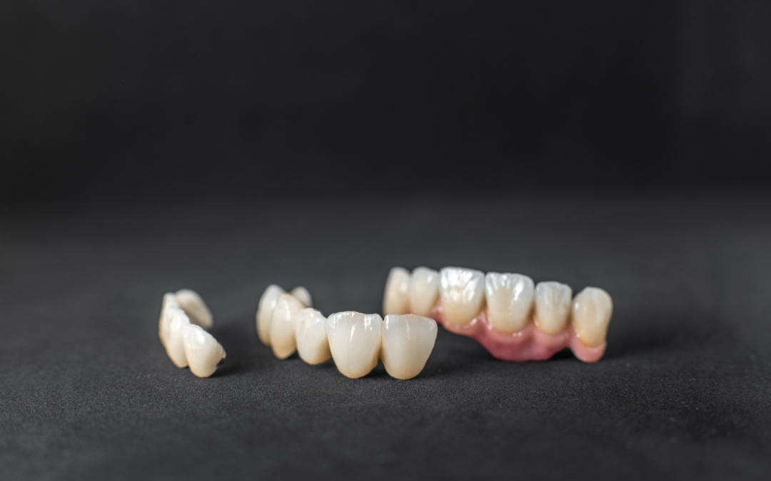 What Should You Do If Your Temporary Crown Breaks